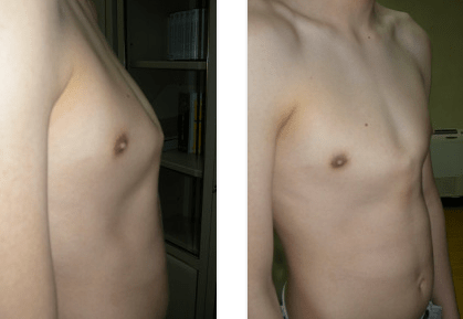 Fig1AB_ToraceAPiccione