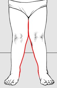 Fig 1: ginocchia a X